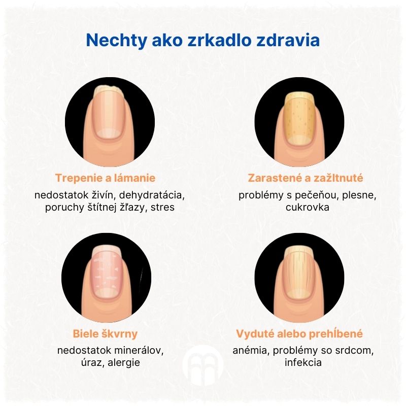 (Slovenčina) Nehty jako zrcadlo zdraví
